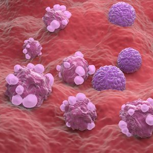 Une équipe internationale étudie comment le sélénium pourrait contribuer à la lutte contre le cancer de l'ovaire